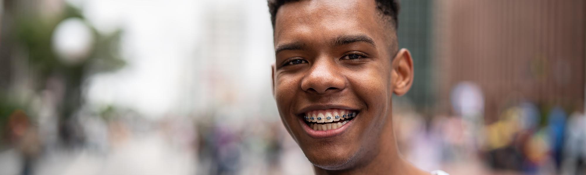 What You Need To Know About Malocclusions