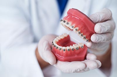 How to Avoid the Most Common Orthodontic Emergencies