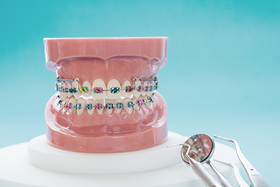 Navigating the Holidays with Braces