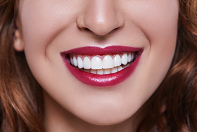 Wishing for a Straighter Smile? Why It’s About More Than Just Aesthetics
