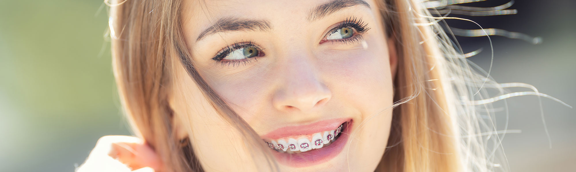 Braces Carson CA