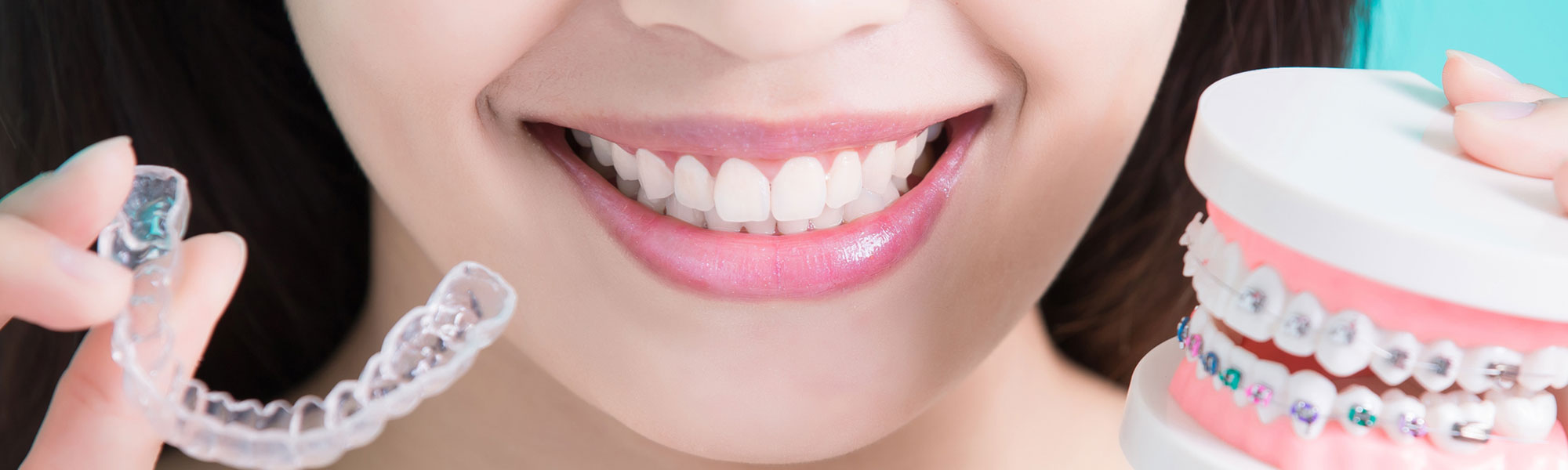 Orthodontics FAQs